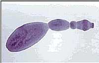 echinococcus granulosis